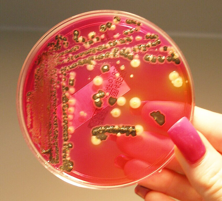 ΣΥΝΑΓΕΡΜΟΣ ΣΤΟ ΚΕΜΠΕΚ: Ανακλήσεις προϊόντων με φυστίκια ΛΟΓΩ ΣΑΛΜΟΝΕΛΑΣ